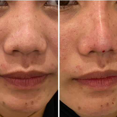 Untitled design (98)