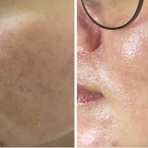 Untitled design (99)